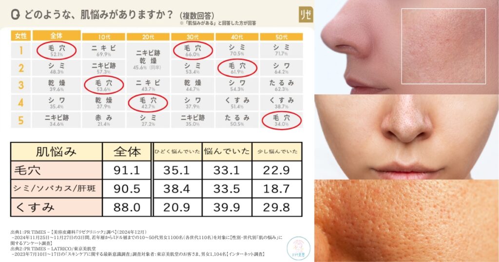 「女性」の人たちの肌悩み。どのような、肌悩みがありますか?